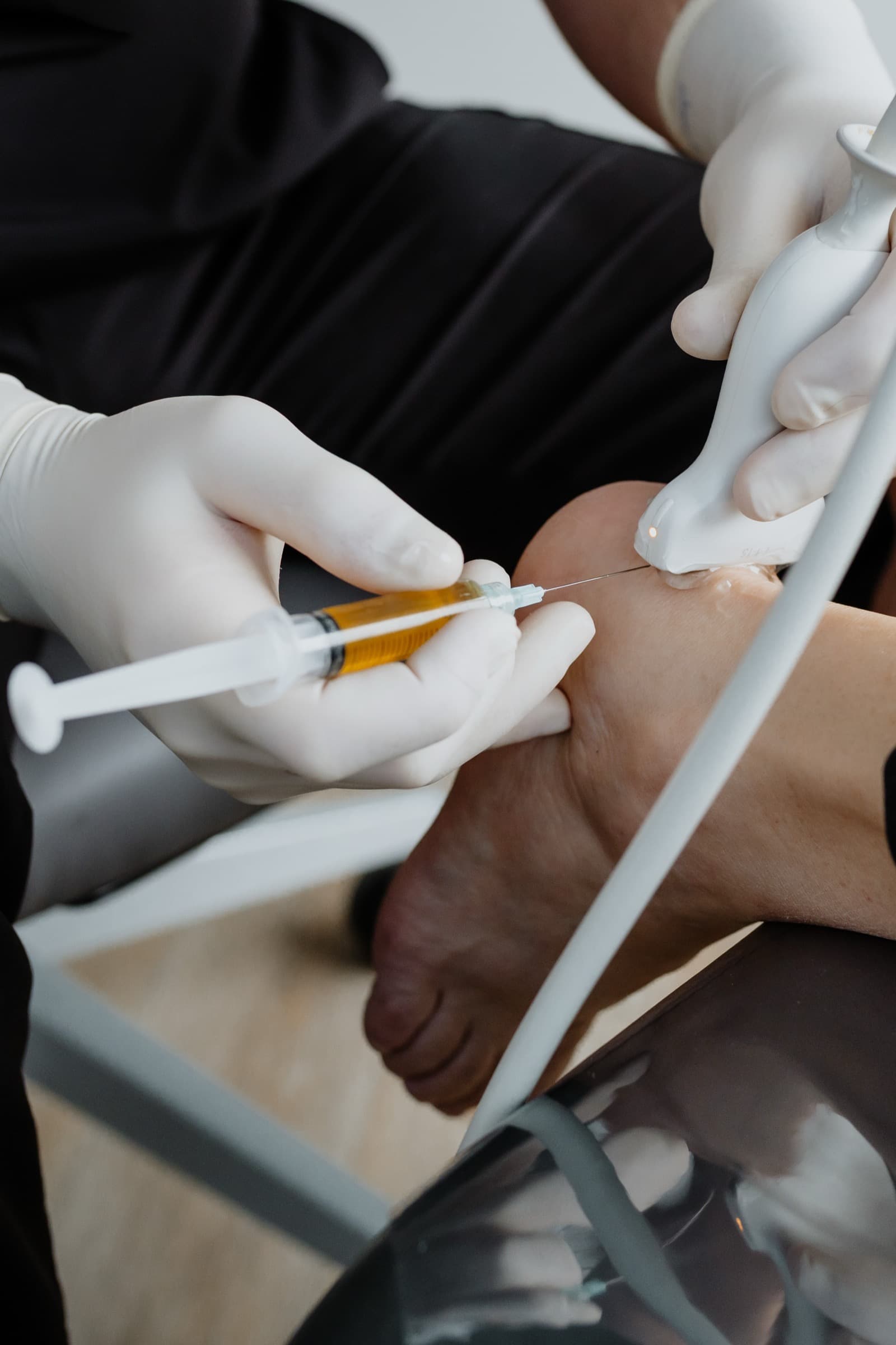 Plasma riche en plaquettes (PRP)